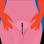 What Are Dilators and How Do They Help Vaginismus?